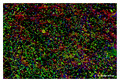"Brain tissue" (not real)