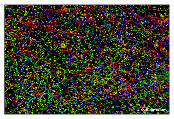 "Brain tissue" (not real)